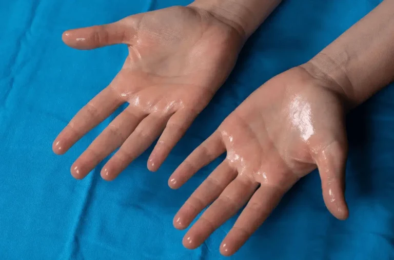 A Step-by-Step Guide to Hyperhidrosis Surgery Singapore